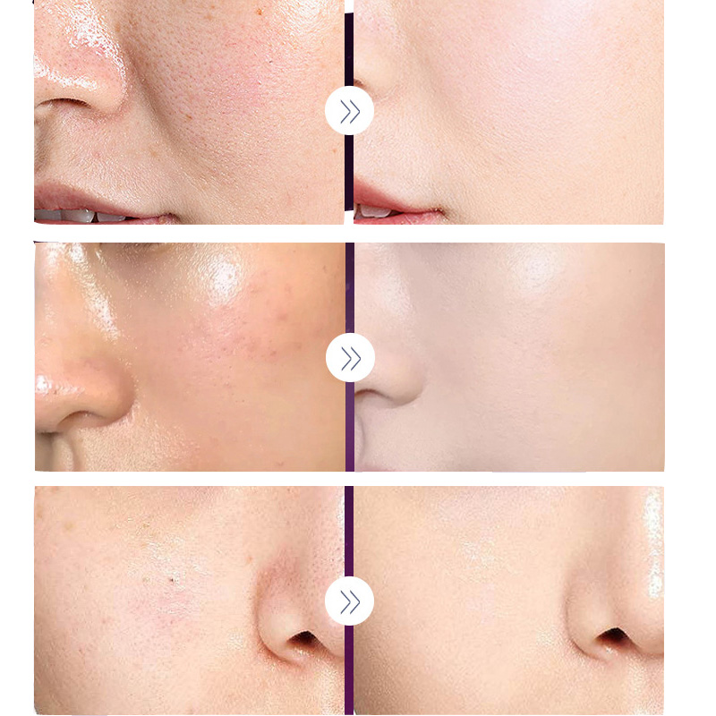 Luxo nobre senhora pérola bran - Luxury Skincare For Women avaliação e preço